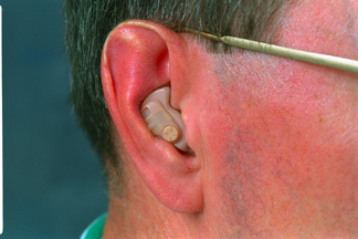 Analog Hearing Aid